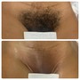 Brazilian Wax