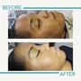 Customized Facial Treatment | 60 minutes