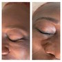 Eyelash Extension Removal