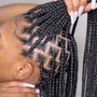 Removal Of Braids