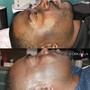 Gentleman’s Ingrown Facial