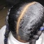 Scalp Treatment