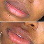 Lip Sugaring