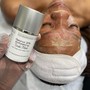 Chemical peel