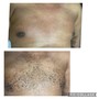 Men’s Brazilian Wax