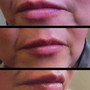 Lips- 1 ML Lip Infusion