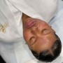 Acne Facial