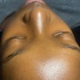 Intimate facials