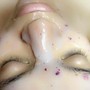 Intimate facials