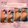 Needleless Mesotherapy