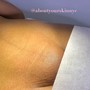 Underarms with Steam extractions