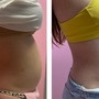 Laser Lipo and Detox Sauna