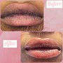 Dark Lip Correction (Lip Neutralizer)