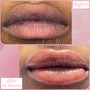 Dark Lip Correction (Lip Neutralizer)