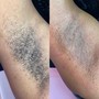 Underarm Wax