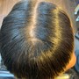 Scalp Treatment