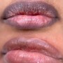 Lips