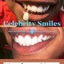 Teeth Whitening (Standard)