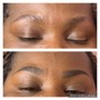 Permanent Makeup Removal