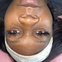 Eyelash Extension Removal