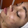 New client Facial