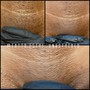 Butt facial/wax