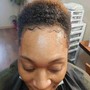 Scalp Treatment