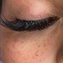 Eyelash Extension Removal