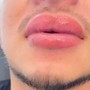 Semi-Permanent Lip Tint (1st Follow Up Included)