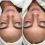 HydraFacial- Back Facial