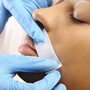 Dermaplaning (FACIAL REQUIRED)