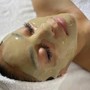 Microdermabrasion (FACIAL REQUIRED)