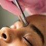 Microdermabrasion (FACIAL REQUIRED)