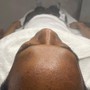 Back Facial