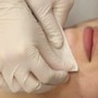 Microdermabrasion (FACIAL REQUIRED)