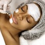 Acne facial (Add-on’s included)