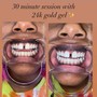 60 min Teeth Whitening - 24K gold