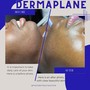 Dermaplaning