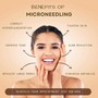 MicroNeedling