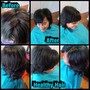 Hair Restoring Treatment