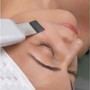 Microdermabrasion Crystal Facial Treamtent