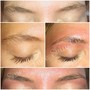 Eye Lash Removal