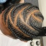 Loc Coils