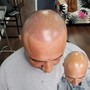 SCALP MICROPIGMENTATION [SMP] starting at $700 [CALL FOR ESTIMATE] AND BOOK APPOINTMENTS...200 DEPOSIT REQUIRED