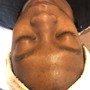 Oxygen Facial