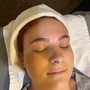 Custom Facial