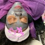 Acne Facial