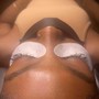 Microdermabrasion Facial