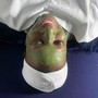 Acne Facial