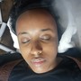 Microdermabrasion Facial